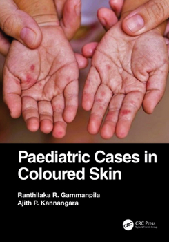 Paperback Paediatric Cases in Coloured Skin Book