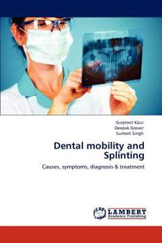 Paperback Dental mobility and Splinting Book