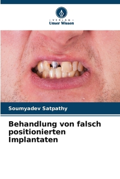 Paperback Behandlung von falsch positionierten Implantaten [German] Book