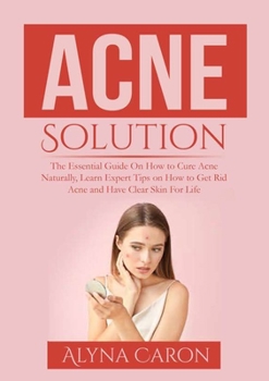 Paperback Acne Solution: The Essential Guide On How to Cure Acne Naturally, Learn Expert Tips on How to Get Rid Acne and Have Clear Skin For Life Book