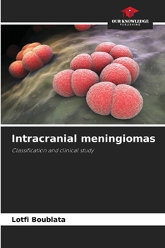 Paperback Intracranial meningiomas Book