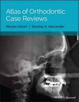 Paperback Atlas of Orthodontic Case Reviews Book