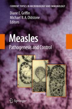 Hardcover Measles: Pathogenesis and Control Book
