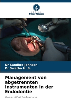Management von abgetrennten Instrumenten in der Endodontie (German Edition)