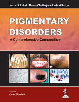 Pigmentary Disorders: A Comprehensive Compendium