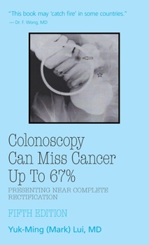 Hardcover Colonoscopy: Can Miss Cancer Up to 67%_Presenting Near Complete Rectification Book