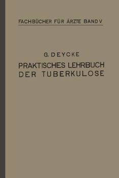 Paperback Praktisches Lehrbuch Der Tuberkulose [German] Book