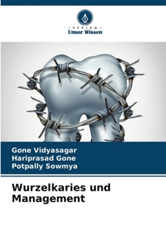 Paperback Wurzelkaries und Management [German] Book