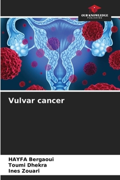 Paperback Vulvar cancer Book
