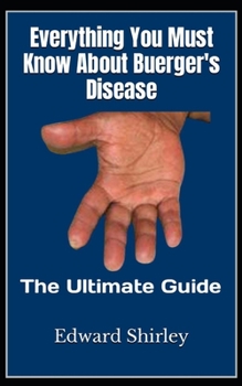 Paperback Everything You Must Know About Buerger's Disease: The Ultimate Guide Book