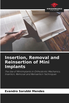 Paperback Insertion, Removal and Reinsertion of Mini Implants Book