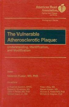 Hardcover The Vulnerable Atherosclerotic Plaque: Project Planning and Estimating Book