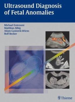 Hardcover Ultrasound Diagnosis of Fetal Anomalies Book