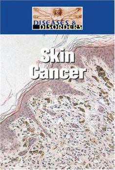 Library Binding Skin Cancer Book