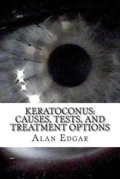 Paperback Keratoconus: Causes, Tests, and Treatment Options Book