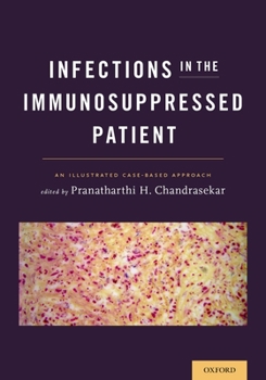 Paperback Infections in the Immunosuppressed Patient: An Illustrated Case-Based Approach Book