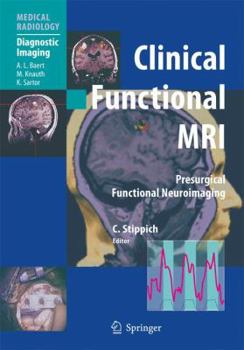Paperback Clinical Functional MRI: Presurgical Functional Neuroimaging Book