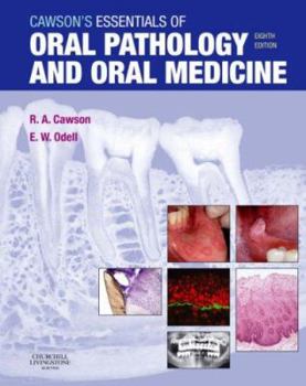 Paperback Cawson's Essentials of Oral Pathology and Oral Medicine Book