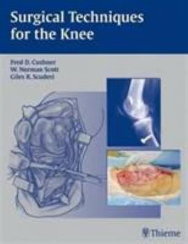 Surgical Techniques Of The Knee