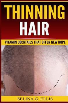 Paperback Thinning Hair: Vitamin Cocktails That Offer New Hope Book