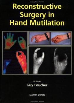 Hardcover Reconstructive Surgery In Hand Mutilation Book