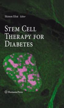 Paperback Stem Cell Therapy for Diabetes Book