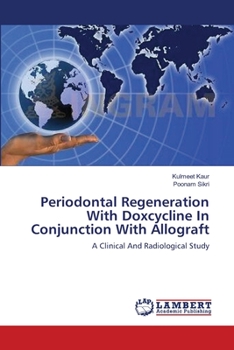 Paperback Periodontal Regeneration With Doxcycline In Conjunction With Allograft Book