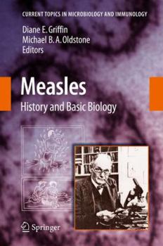 Hardcover Measles: History and Basic Biology Book