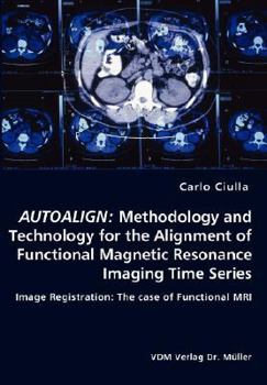 Paperback Autoalign: Methodology and Technology for the Alignment of Functional Magnetic Resonance Imaging Time Series Book