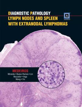 Hardcover Diagnostic Pathology: Lymph Nodes and Spleen with Extranodal Lymphomas: Published by Amirsys Book