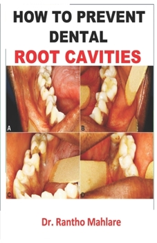 Paperback How to Prevent Dental Root Cavities Book