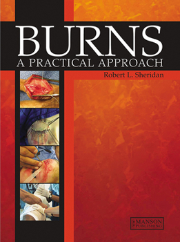 Hardcover Burns: A Practical Approach to Immediate Treatment and Long Term Care Book