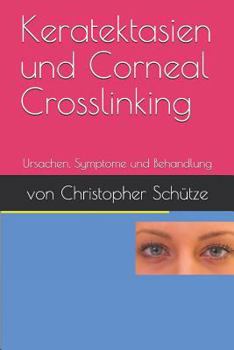 Paperback Keratektasien, Corneal Crosslinking: Ursachen, Symptome Und Behandlung [German] Book