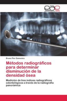 Paperback Métodos radiográficos para determinar disminución de la densidad ósea [Spanish] Book