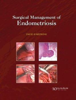 Hardcover Surgical Management of Endometriosis Book