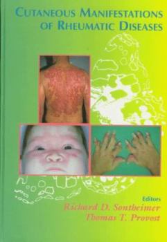 Hardcover Cutaneous Manifestations of Rheumatic Diseases Book