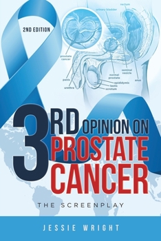 Paperback 3rd Opinion on Prostate Cancer: The Screenplay Book