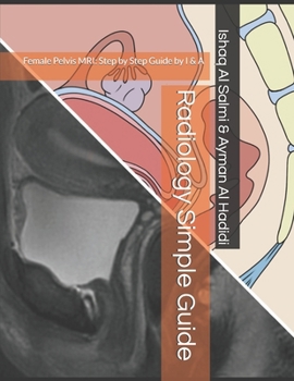 Radiology Simple Guide: Female Pelvis MRI: Step by Step Guide by I & A
