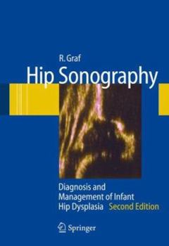 Paperback Hip Sonography: Diagnosis and Management of Infant Hip Dysplasia Book
