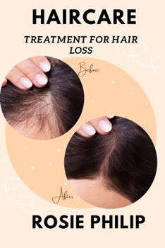 Paperback Haircare: Treatment for hair loss Book