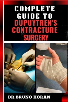 COMPLETE GUIDE TO DUPUYTREN’S CONTRACTURE SURGERY: Comprehensive Manual To Advanced Techniques, Recovery, and Best Practices for Optimal Oral Health