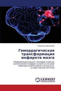 Paperback Gemorragicheskaya Transformatsiya Infarkta Mozga [Russian] Book