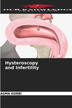 Paperback Hysteroscopy and Infertility Book