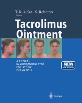 Paperback Tacrolimus Ointment: A Topical Immunomodulator for Atopic Dermatitis Book