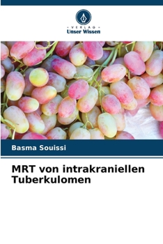 Paperback MRT von intrakraniellen Tuberkulomen [German] Book