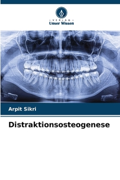 Paperback Distraktionsosteogenese [German] Book