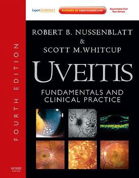 Hardcover Uveitis: Fundamentals and Clinical Practice Book