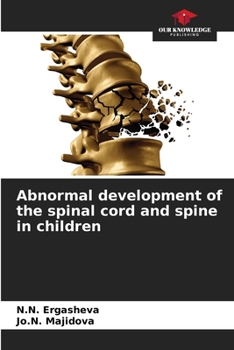 Paperback Abnormal development of the spinal cord and spine in children Book