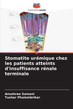 Paperback Stomatite urémique chez les patients atteints d'insuffisance rénale terminale [French] Book