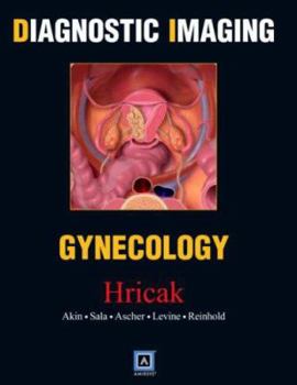 Hardcover Diagnostic Imaging: Gynecology Book